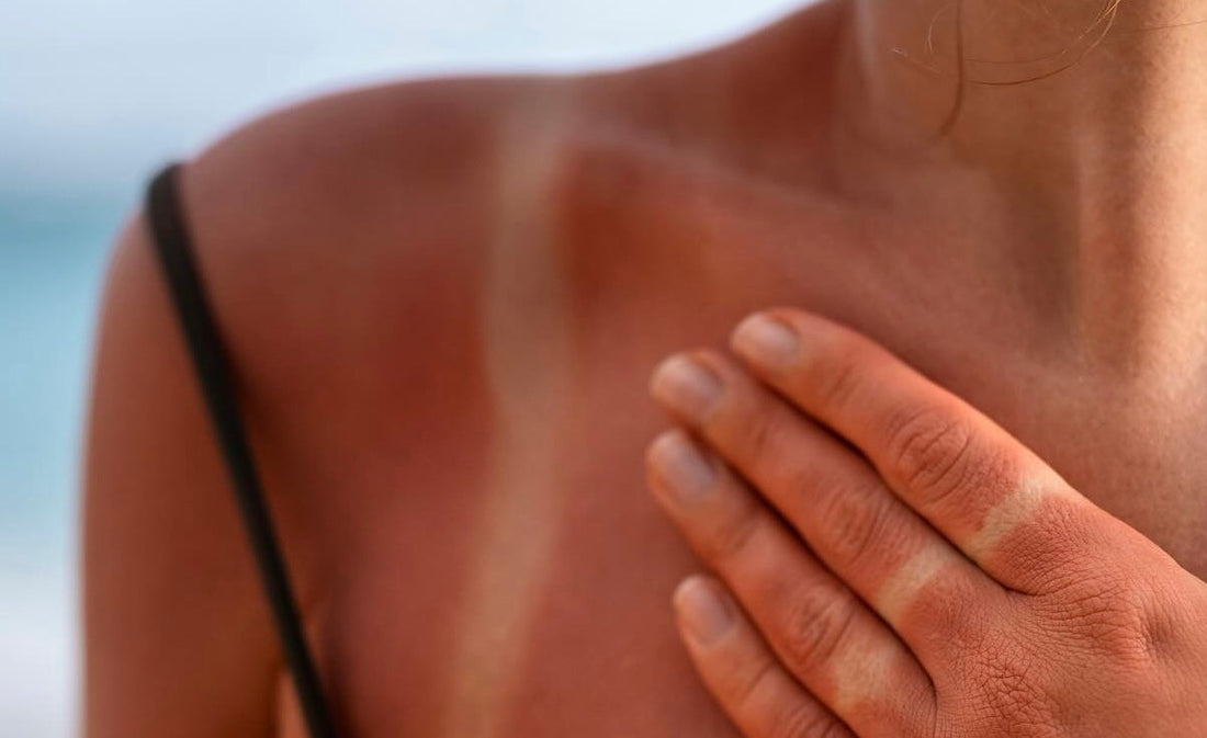 The Importance of Wearing Sunscreen