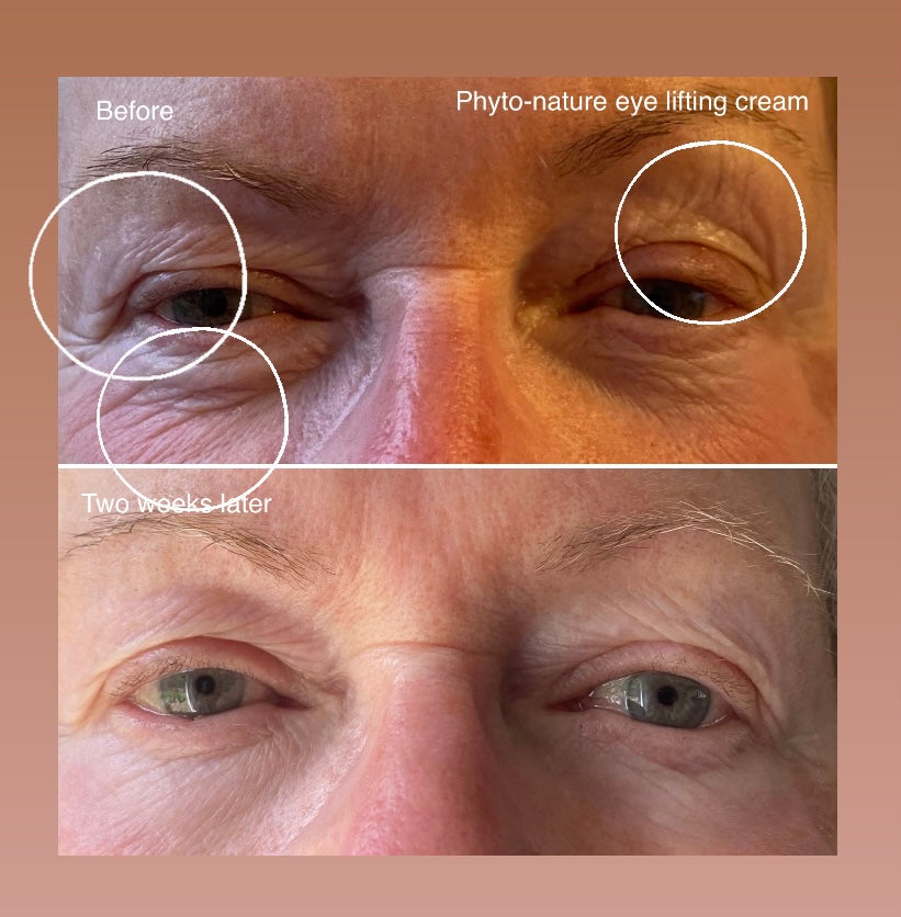 Dermalogica Phyto Nature Lifting Eye Cream