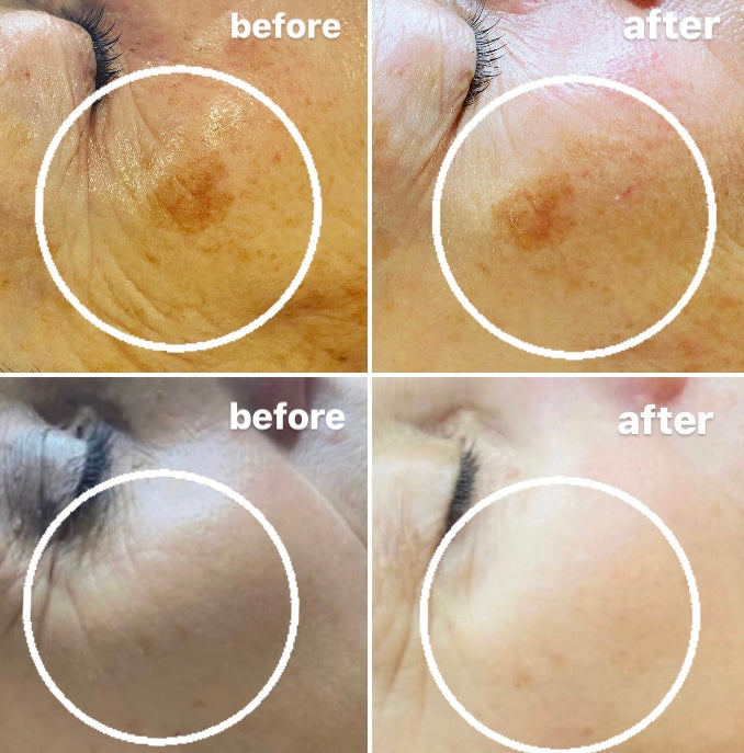 dermalogica chemical peel colchester