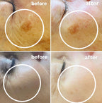 dermalogica chemical peel colchester